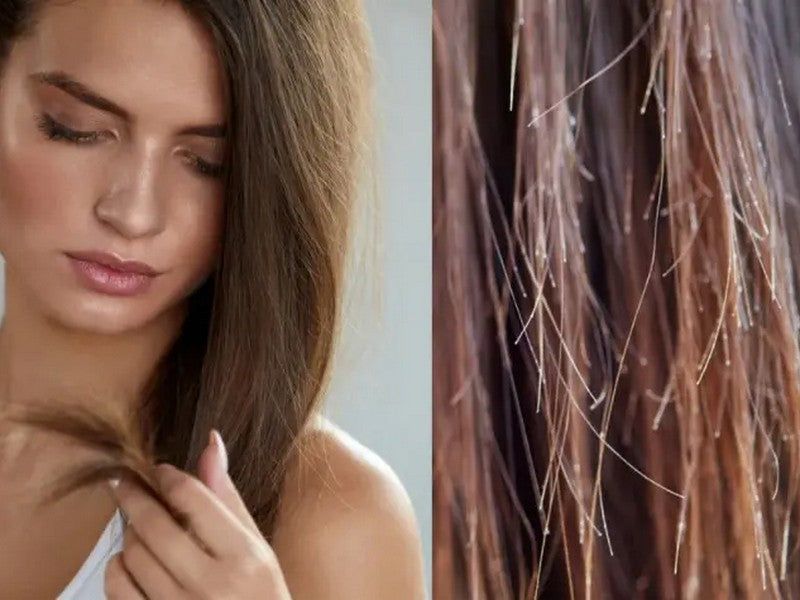 reconnaitre fourches cheveux