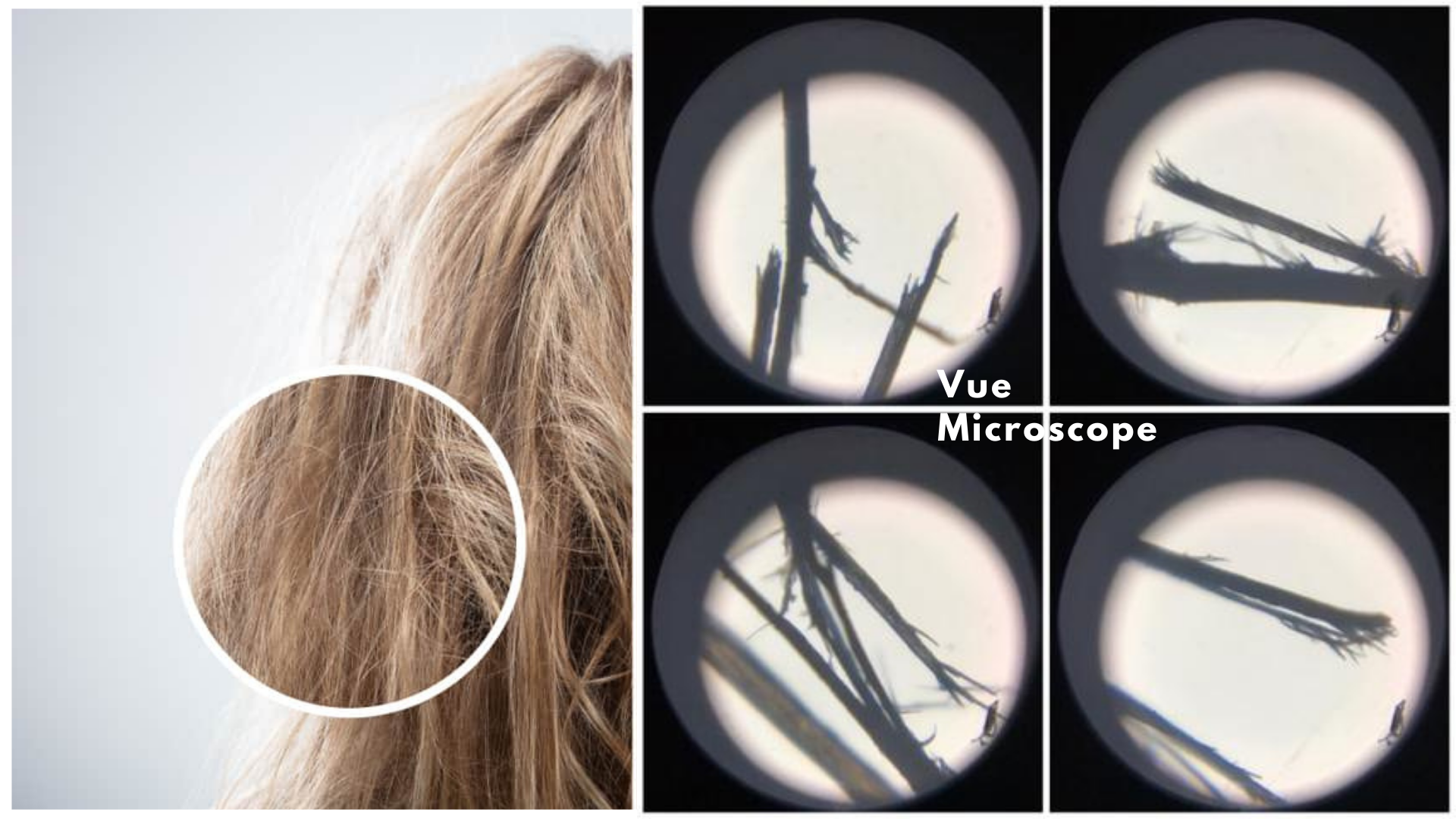 Split Ends Microscope