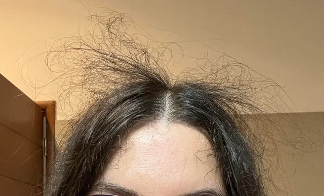 Pourquoi a-t-on des frisottis sur le dessus de la tête et comment s'en débarrasser ?